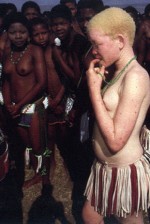 Campanha da Benetton de 1992, que mostra um albino cercado por seus conterrâneos negros